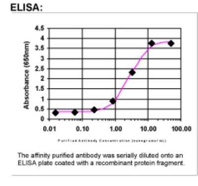 ELISA: SACS Antibody [24340002]