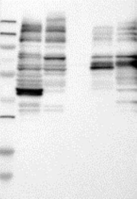 Western Blot: SACS Antibody [24340002] - Samples:  Lane 1, Marker [kDa]: 250, 130, 95, 72, 55, 36, 28, 17, 11  Lane 2, RT-4  Lane 3, U-251MG sp  Lane 4, Human Plasma  Lane 5, Liver  Lane 6, Tonsil ,   Target weight [kDa]:   521, 505, 437, 37 (splice variants)    Validation score:  2   Validation description:   Supportive - Band of predicted size in kDa (+/-20%) with additional bands present.