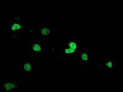 Immunocytochemistry/Immunofluorescence: SAE2 Antibody (OTI4A3) - Azide and BSA Free [NBP2-73973] - Staining of COS7 cells transiently transfected by pCMV6-ENTRY SAE2.