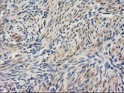 Immunohistochemistry: SAE2 Antibody (OTI4A3) - Azide and BSA Free [NBP2-73973] - Staining of paraffin-embedded Human endometrium tissue using anti-SAE2 mouse monoclonal antibody.