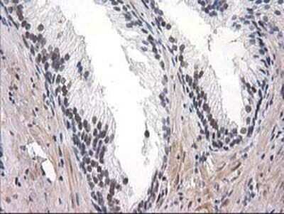 Immunohistochemistry: SAE2 Antibody (OTI4A3) - Azide and BSA Free [NBP2-73973] - Staining of paraffin-embedded Human prostate tissue using anti-SAE2 mouse monoclonal antibody.