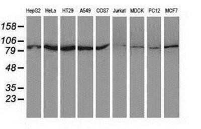 Western Blot: SAE2 Antibody (OTI4A3) - Azide and BSA Free [NBP2-73973] - Analysis of extracts (35ug) from 9 different cell lines by using anti-SAE2 monoclonal antibody.