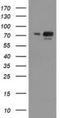 Western Blot: SAE2 Antibody (OTI4A3) - Azide and BSA Free [NBP2-73973] - HEK293T cells were transfected with the pCMV6-ENTRY control (Left lane) or pCMV6-ENTRY SAE2 (Right lane) cDNA for 48 hrs and lysed. Equivalent amounts of cell lysates (5 ug per lane) were separated by SDS-PAGE and immunoblotted with anti-SAE2.