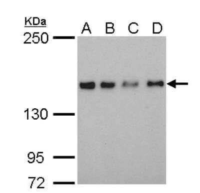 Western Blot: SAFB Antibody (6F7) [NB200-332] - A. 30 ug 293T whole cell lysate/extract B. 30 ug A431 whole cell lysate/extract C. 30 ug HeLa whole cell lysate/extract D. 30 ug HepG2 whole cell lysate/extract 5% SDS-PAGE SAFB antibody dilution: 1:1000  The HRP-conjugated anti-mouse IgG antibody was used to detect the primary antibody.