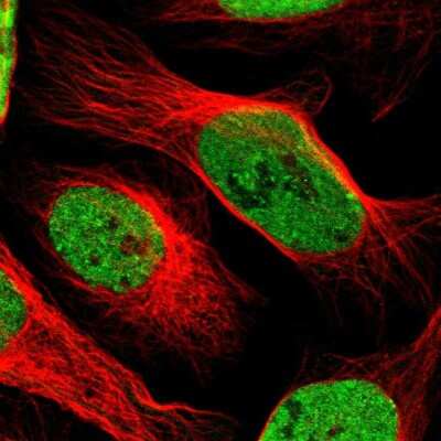 Immunocytochemistry/Immunofluorescence: SAFB Antibody [NBP1-83266] - Immunofluorescent staining of human cell line U-2 OS shows localization to nucleoplasm.