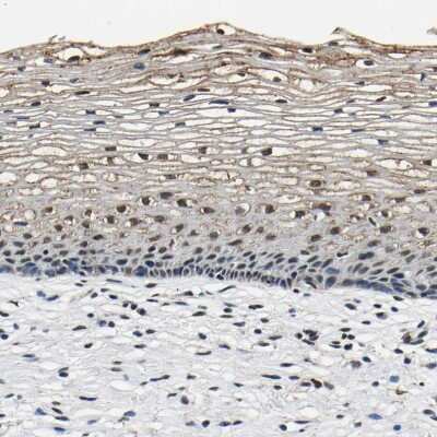 Immunohistochemistry-Paraffin: SAFB Antibody [NBP1-83265] - Staining of human cervix, uterine shows moderate nuclear and cytoplasmic positivity in squamous epithelial cells.