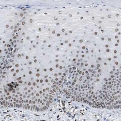 Immunohistochemistry-Paraffin: SAFB Antibody [NBP1-83266] - Staining of human cervix, uterine shows moderate nuclear positivity in squamous epithelial cells.