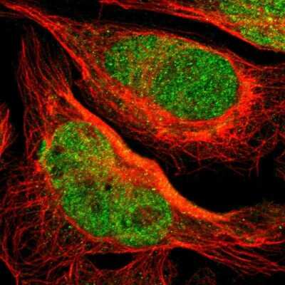 Immunocytochemistry/ Immunofluorescence SAGE1 Antibody