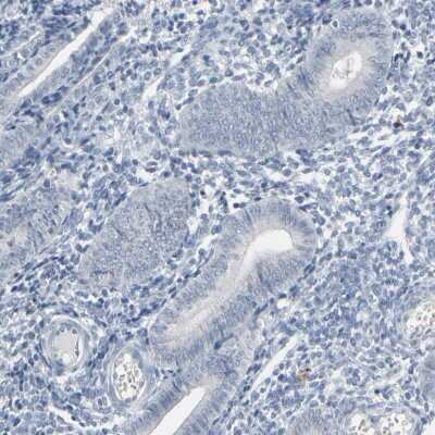 Immunohistochemistry-Paraffin SAGE1 Antibody