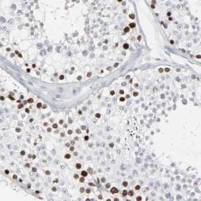 Immunohistochemistry-Paraffin SAGE1 Antibody