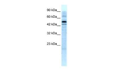 Western Blot: SALF Antibody [NBP2-86790] - WB Suggested Anti-SALF Antibody Titration: 5.0ug/ml. ELISA Titer: 1:62500. Positive Control: HepG2 cell lysate