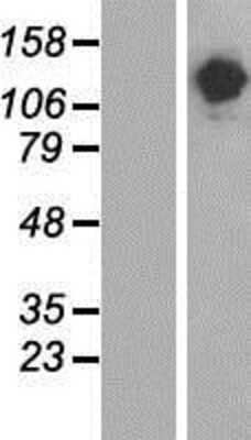 Western Blot: SALF Overexpression Lysate (Adult Normal) [NBP2-05159] Left-Empty vector transfected control cell lysate (HEK293 cell lysate); Right -Over-expression Lysate for SALF.