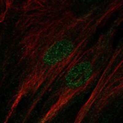 Immunocytochemistry/ Immunofluorescence SALL1 Antibody - BSA Free
