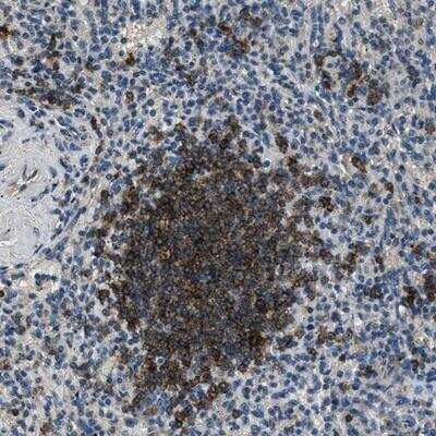 Immunohistochemistry-Paraffin: SALL3 Antibody [NBP1-80587] - Staining of human spleen shows strong cytoplasmic positivity in the white pulp.