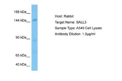 Western Blot: SALL3 Antibody [NBP2-83490] - Host: Rabbit. Target Name: SALL3. Sample Tissue: Human A549 Whole Cell lysates. Antibody Dilution: 1ug/ml