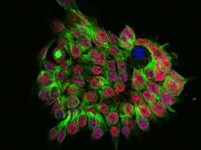 Immunocytochemistry/Immunofluorescence: SALL4 Antibody [NBP2-98704] - Immunofluorescence staining of SALL4 in HESS9 cells. Cells were fixed with 4% PFA, blocked with 10% serum, and incubated with rabbit anti-human SALL4 polyclonal antibody (1:1000) at 4C overnight. Then cells were stained with the Alexa Fluor(R)594-conjugated Goat Anti-rabbit IgG secondary antibody (red), counterstained beta-tubulin (green) and DAPI (blue). Positive staining was localized to nucleus.