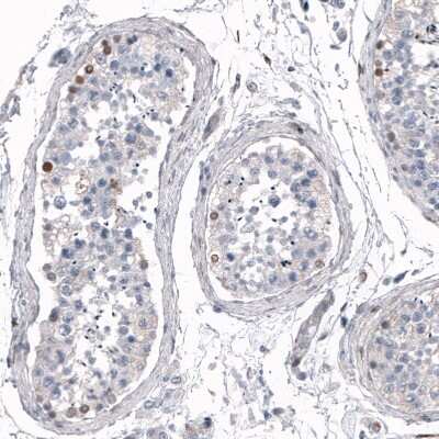 Immunohistochemistry-Paraffin: SALL4 Antibody [NBP1-84247] - Staining of human testis shows weak to moderate nuclear positivity in a subset of cells in seminiferous ducts.