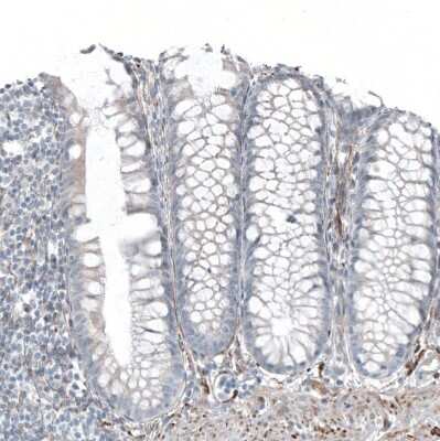 Immunohistochemistry-Paraffin: SALL4 Antibody [NBP1-84247] - Staining of human colon shows no positivity in glandular cells as expected.