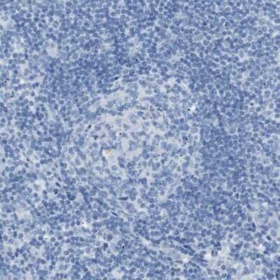 Immunohistochemistry-Paraffin: SALL4 Antibody [NBP1-85206] - Staining of human lymph node shows no positivity in germinal center cells.