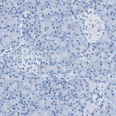 Immunohistochemistry-Paraffin: SALL4 Antibody [NBP1-85206] - Staining of human pancreas shows no positivity in exocrine glandular cells.