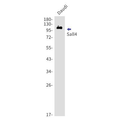Western Blot: SALL4 Antibody (S02-6H7) [NBP3-19766] - Western blot detection of SALL4 in Daudi using NBP3-19766. Predicted band size: 112kDa. Observed band size: 112kDa.