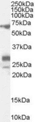 Western Blot: SALL4 Antibody [NB100-60559] -  (0.1ug/ml) staining of Rat Testis lysate (35ug protein in RIPA buffer). Primary incubation was 1 hour. Detected by chemiluminescence.