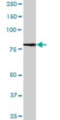 Western Blot: SALM2/LRFN1 Antibody [H00057622-B01P] - Analysis of LRFN1 expression in human kidney.