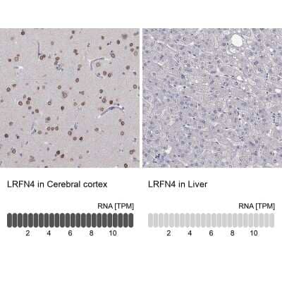 Immunohistochemistry-Paraffin: SALM3/LRFN4 Antibody [NBP3-17090] - Analysis in human cerebral cortex and liver tissues using Anti-LRFN4 antibody. Corresponding LRFN4 RNA-seq data are presented for the same tissues.