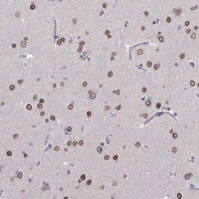 Immunohistochemistry-Paraffin: SALM3/LRFN4 Antibody [NBP3-17090] - Staining of human cerebral cortex shows high expression.