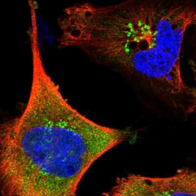 Immunocytochemistry/ Immunofluorescence SAMD12 Antibody - BSA Free