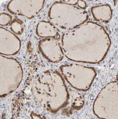 Immunohistochemistry-Paraffin SAMD12 Antibody - BSA Free