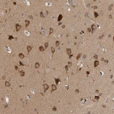Immunohistochemistry-Paraffin SAMD12 Antibody - BSA Free