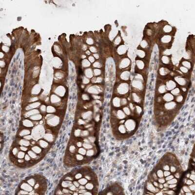 Immunohistochemistry-Paraffin SAMD12 Antibody - BSA Free