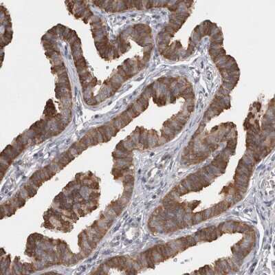 Immunohistochemistry-Paraffin SAMD12 Antibody - BSA Free