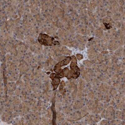 Immunohistochemistry-Paraffin SAMD12 Antibody - BSA Free