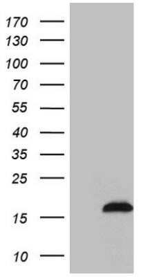 Western Blot: SAMD12 Antibody (OTI2G1) - Azide and BSA Free [NBP2-73974] - HEK293T cells were transfected with the pCMV6-ENTRY control (Left lane) or pCMV6-ENTRY SAMD12 (Right lane) cDNA for 48 hrs and lysed. Equivalent amounts of cell lysates (5 ug per lane) were separated by SDS-PAGE and immunoblotted with anti-SAMD1.