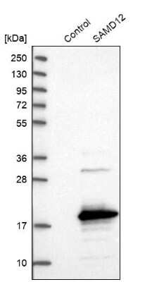 Western Blot SAMD12 Antibody - BSA Free