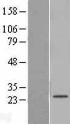 Western Blot: SAMD12 Overexpression Lysate (Adult Normal) [NBL1-15680] Left-Empty vector transfected control cell lysate (HEK293 cell lysate); Right -Over-expression Lysate for SAMD12.