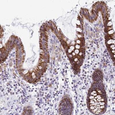 Immunohistochemistry-Paraffin: SAMD13 Antibody [NBP2-31734] - Staining of human colon shows high expression.