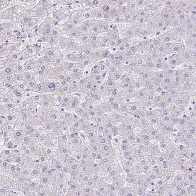 Immunohistochemistry-Paraffin: SAMD13 Antibody [NBP2-31734] - Staining of human liver shows low expression as expected.