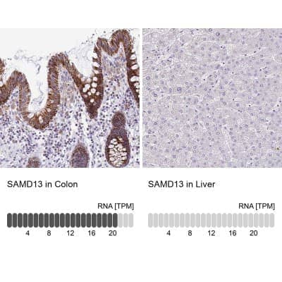 Immunohistochemistry-Paraffin: SAMD13 Antibody [NBP2-31734] - Staining in human colon and liver tissues using anti-SAMD13 antibody. Corresponding SAMD13 RNA-seq data are presented for the same tissues.