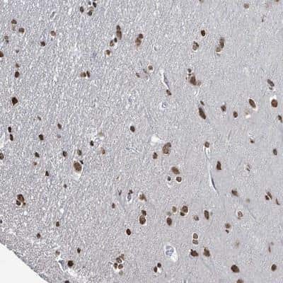 Immunohistochemistry-Paraffin: SAMD14 Antibody [NBP2-13278] - Staining of human cerebral cortex shows strong nuclear positivity in neuronal and glial cells.