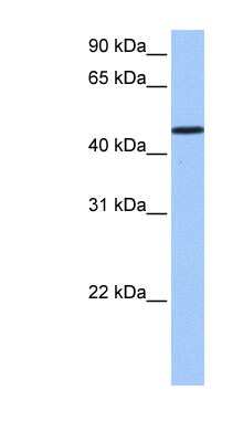 Western Blot: SAMD14 Antibody [NBP1-70699] - Jurkat cell lysate, concentration 0.2-1 ug/ml.
