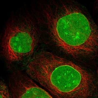 <b>Orthogonal Strategies Validation. </b>Immunocytochemistry/Immunofluorescence: SAMD15 Antibody [NBP1-90727] - Immunofluorescent staining of human cell line A-431 shows localization to nucleus, nucleoli & nuclear membrane.