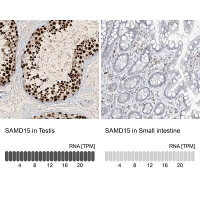 Immunohistochemistry-Paraffin: SAMD15 Antibody [NBP1-90727] - Staining in human testis and small intestine tissues using anti-SAMD15 antibody. Corresponding SAMD15 RNA-seq data are presented for the same tissues.