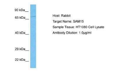 Western Blot: SAMD15 Antibody [NBP2-85684] - Host: Rabbit. Target Name: SAM15. Sample Type: HT1080 Whole Cell lysates. Antibody Dilution: 1.0ug/ml
