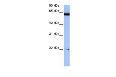 Western Blot: SAMD15 Antibody [NBP2-85685] - WB Suggested Anti-C14orf174 Antibody Titration: 0.2-1 ug/ml. Positive Control: HepG2 cell lysate