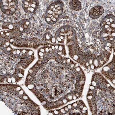 Immunohistochemistry-Paraffin: SAMD3 Antibody [NBP1-88731] - Staining of human small intestine shows strong cytoplasmic positivity with granular pattern in glandular cells.