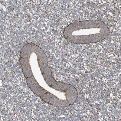 Immunohistochemistry-Paraffin: SAMD3 Antibody [NBP1-88731] - Staining of human endometrium shows moderate to strong granular cytoplasmic positivity in glandular cells.