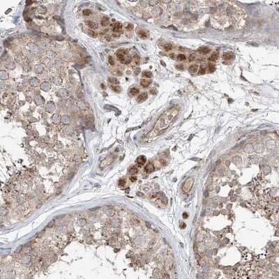 Immunohistochemistry-Paraffin: SAMD3 Antibody [NBP1-88731] - Staining of human testis shows moderate to strong granular cytoplasmic positivity in Leydig cells.